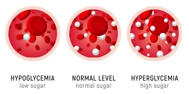 SugaNorm skirtas visų formų diabetui gydyti